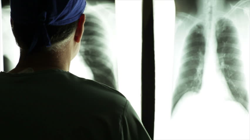 A mature male doctor in a dark room comparing x-rays displayed on illuminated panels.