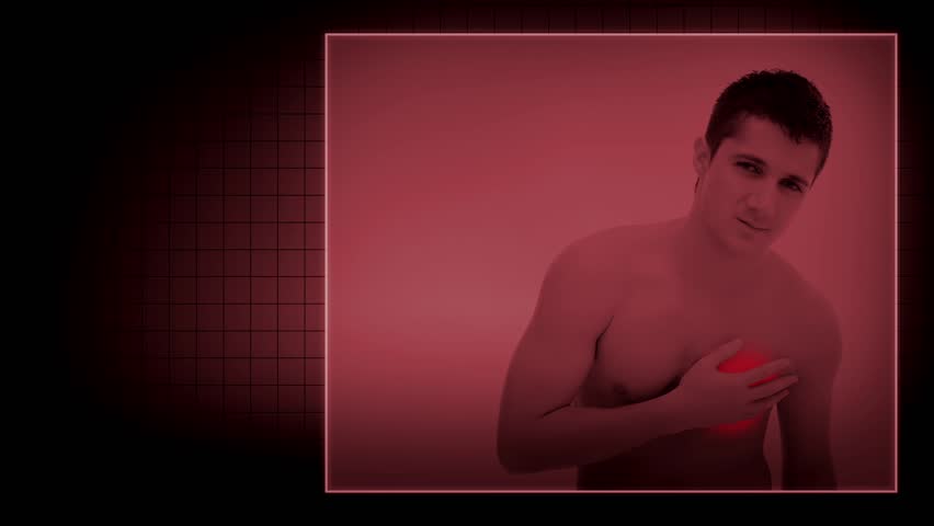Heart attack of a young man with EKG signs 