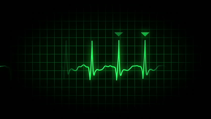 An animated heart monitor EKG line.  Loopable.  With luma matte.