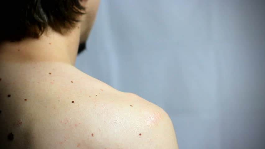 Human moles in close-up. HD1080p.