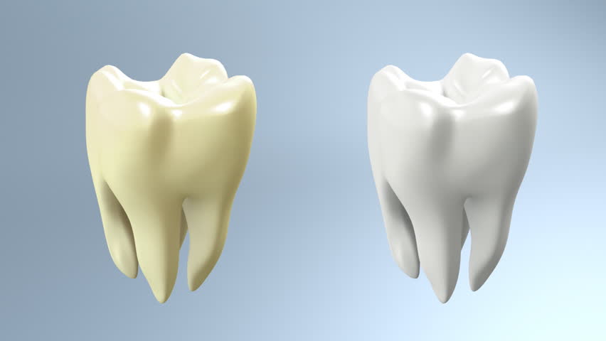  The health of tooth and bad tooth comparison for tooth care concept.