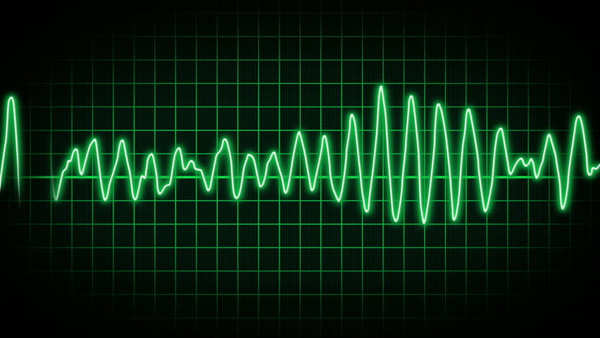 A fictional hospital computer screen monitoring a human heart.  