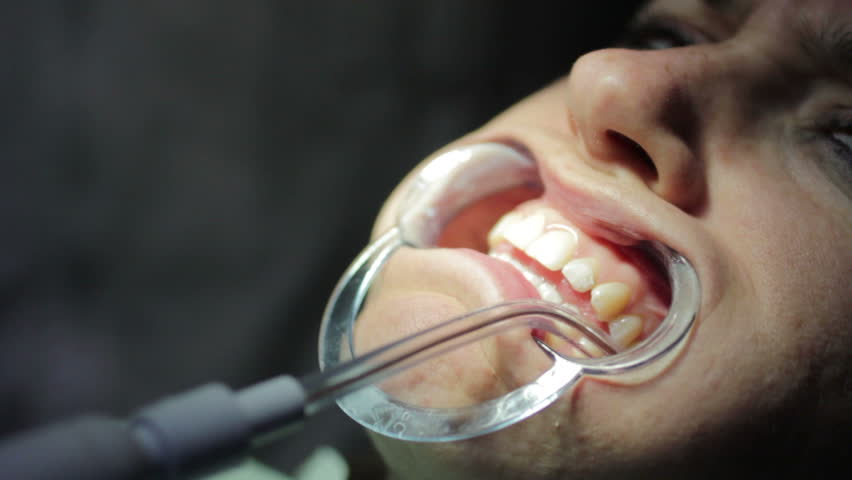 Close-up of patient open mouth during oral checkup
