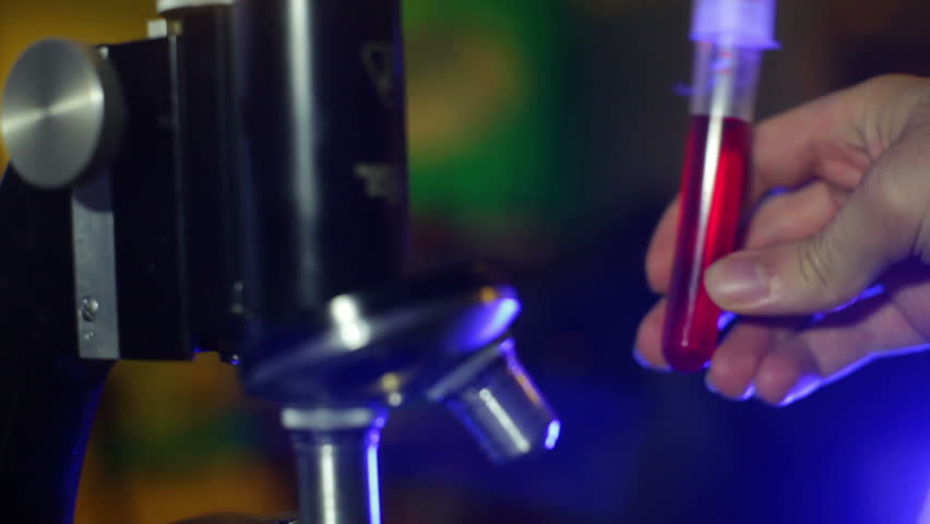 Scientist looking at a blood test