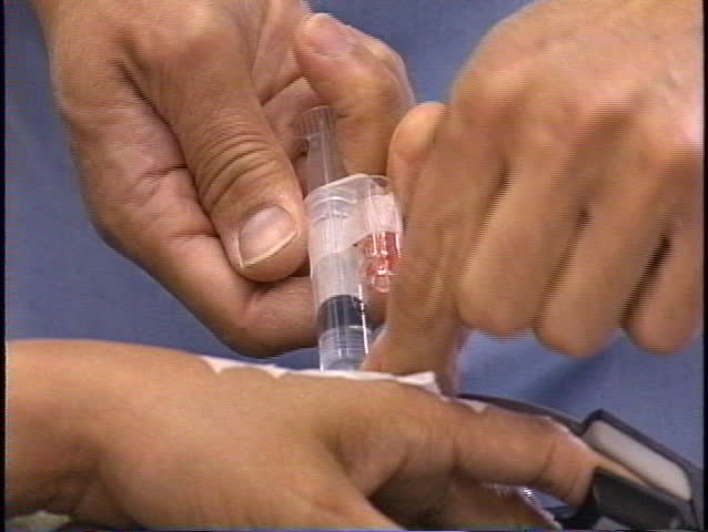 Injecting medication on top of hand