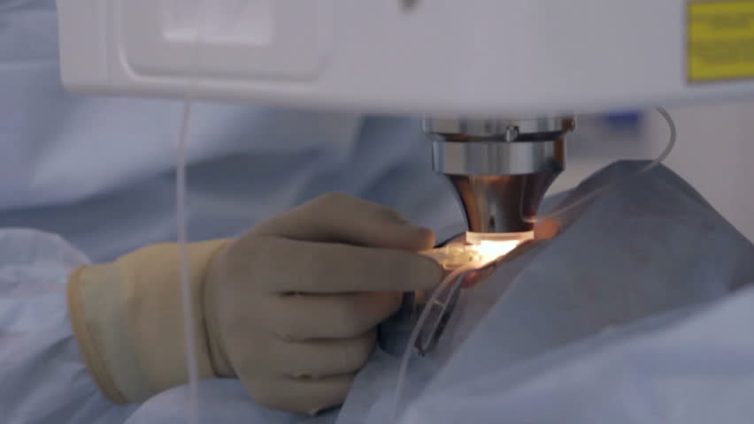 Surgical operations on the human eye