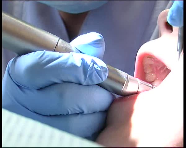 LUGANSK JUNE 8: Central hospital 2. Dentist repair a tooth 2.