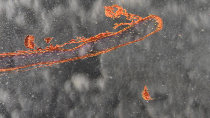 science micrograph of bone cell osteocyte
