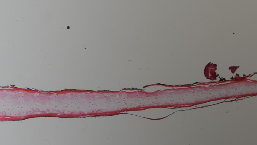 science micrograph of bone cell osteocyte