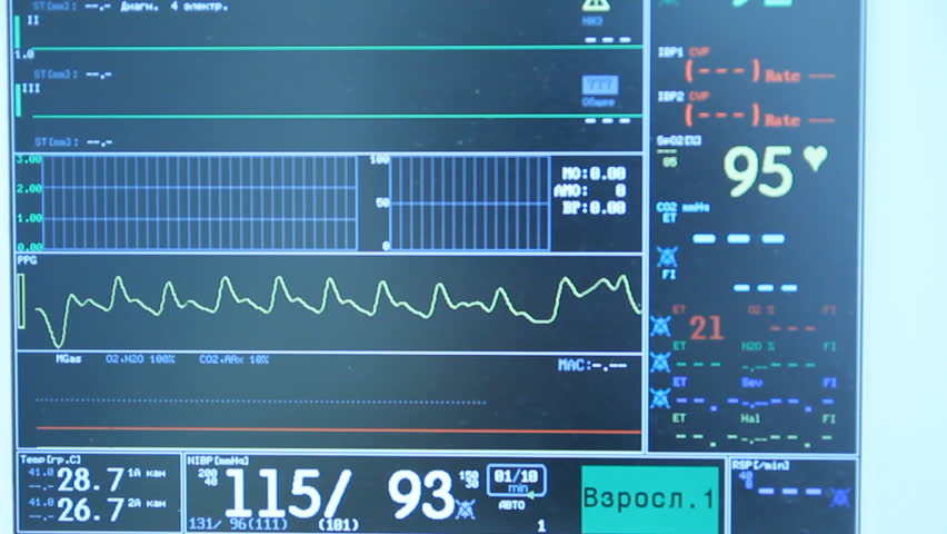 Operating. Hospital. Cardiac