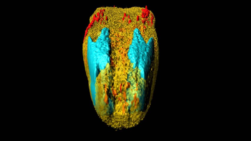 3D model of neurons and muscles in head region of Caenorhabditis elegans, a free-living transparent nematode (roundworm), about 1 mm in length.