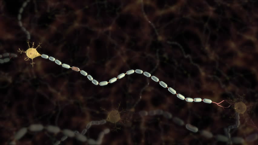 3D animation with close up of demyelination damage caused by multiple sclerosis disrupting action potential conduction down axon slowing neurotransmission between neurons

