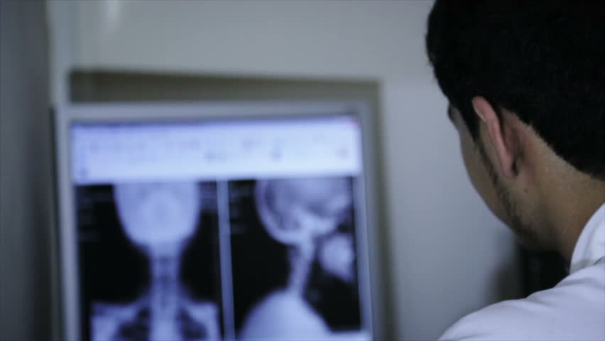 Medical Intern learning how interpret results of MRI on computer