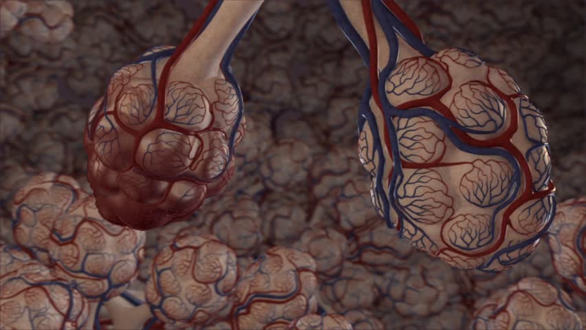 Internal lung visualization of infected alveolar structure with inflammation resulting in reduced oxygen saturation of red blood cells during gas transfer into capillaries