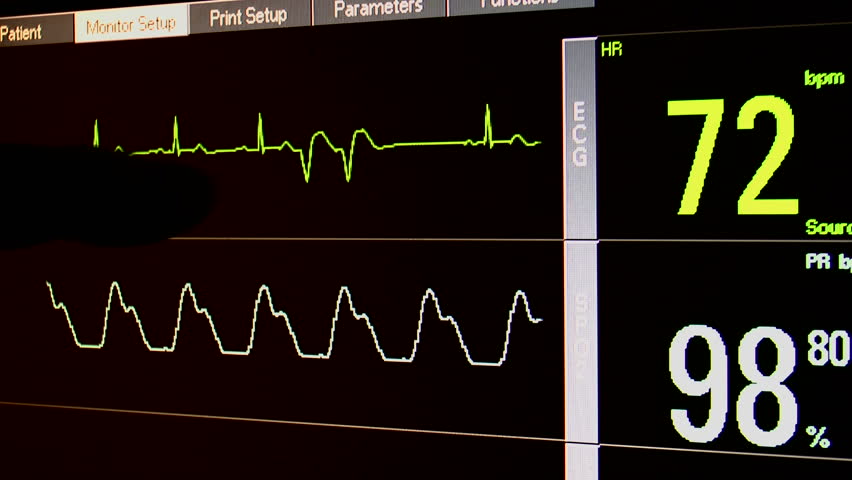 Silhouetted hands of two doctors consulting, reviewing, patient vital sign readings on hospital monitor. 1080p