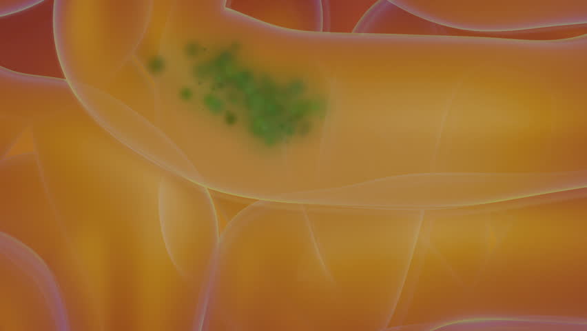 Plague in guts with healing process