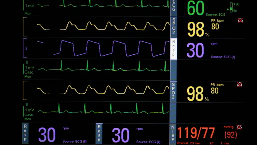 Patient vital signs displayed in colorful electrical waves, critical numbers flashing on computer screen denoting EKG, respiration, blood pressure readings. 1080p 
