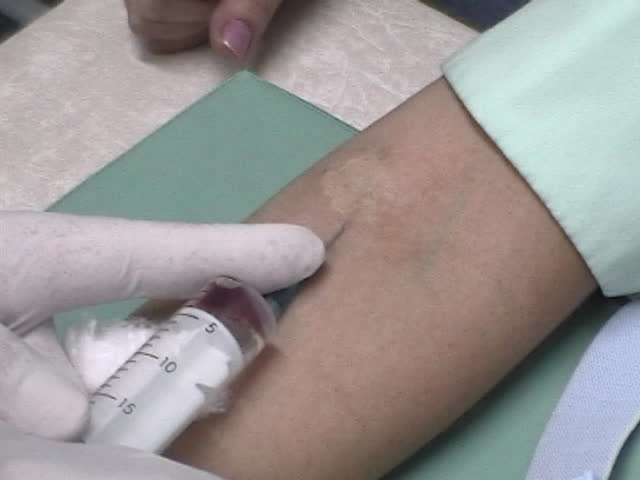 Injection in a vein close up