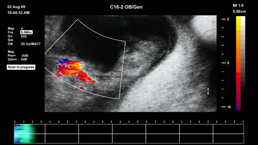 Medical ultrasound scan of human embryo		 
