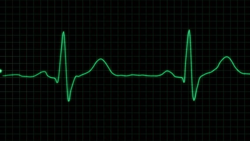 real form cardiogram with alpha