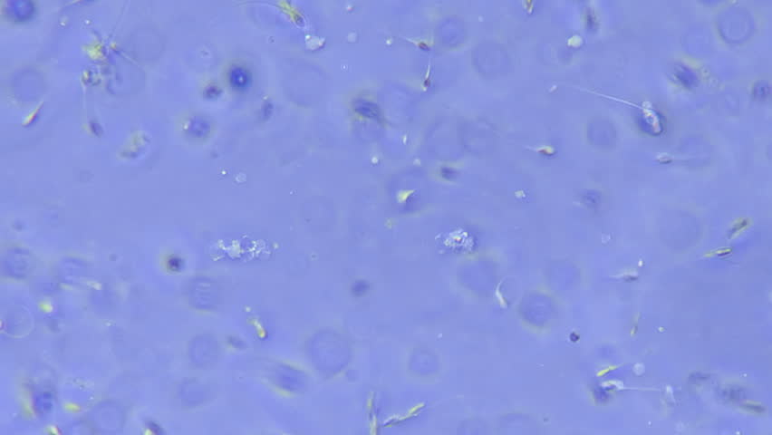 Parquette recommends best of Sperm 750x microscope Robin and starfire cosplay