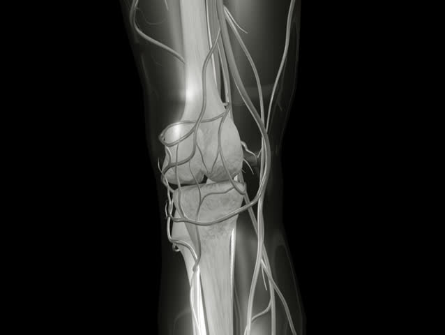 NTSC Knee X-ray