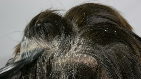 Hair Root Stock Video Footage 4k And Hd Video Clips Shutterstock