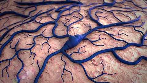 Stroke Brain Insult Brain Model Brain Stock Footage Video (100% Royalty-free) 14031413 | Shutterstock Stroke Brain Insult Brain Model Brain Stock Footage Video (100% Royalty-free) 14031413 | Shutterstock