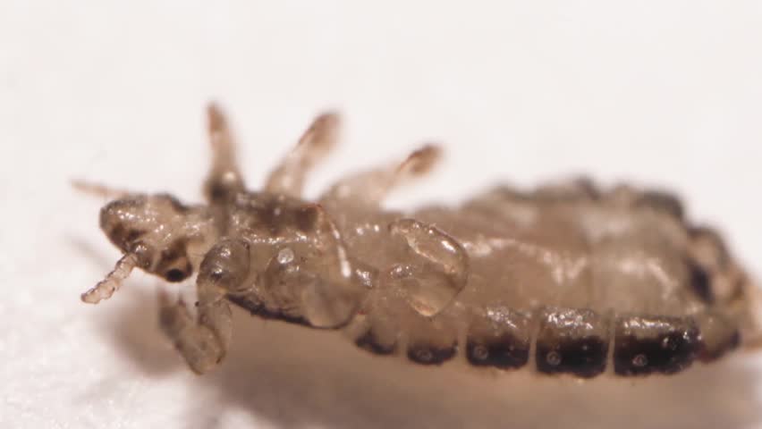 Human Hair Louse Stock Footage Video 100 Royalty Free