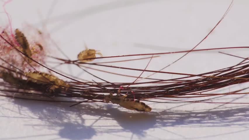 Human Head Lice On The Stock Footage Video 100 Royalty Free