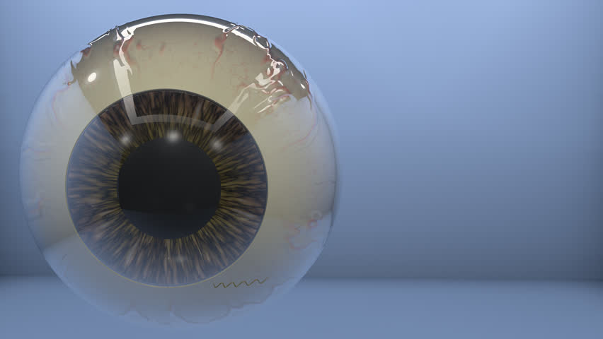 Header of filarial