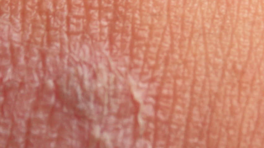 Header of shingles