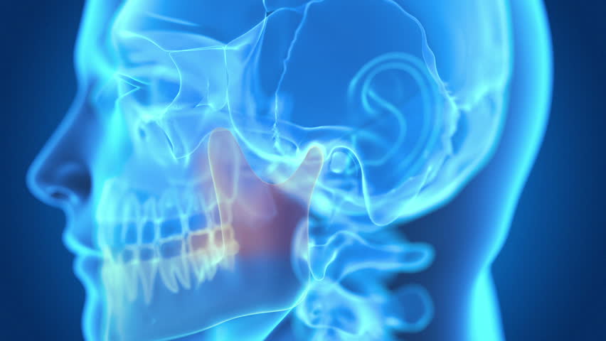 Header of jaw
