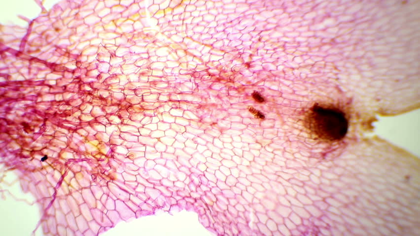Header of prothallium