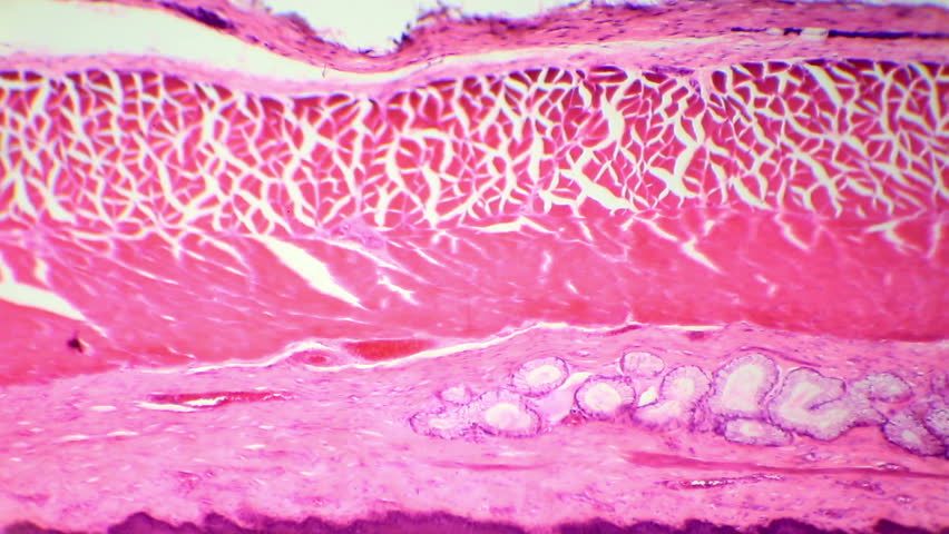 Stratified Squamous Epithelium Under Microscope Micropedia